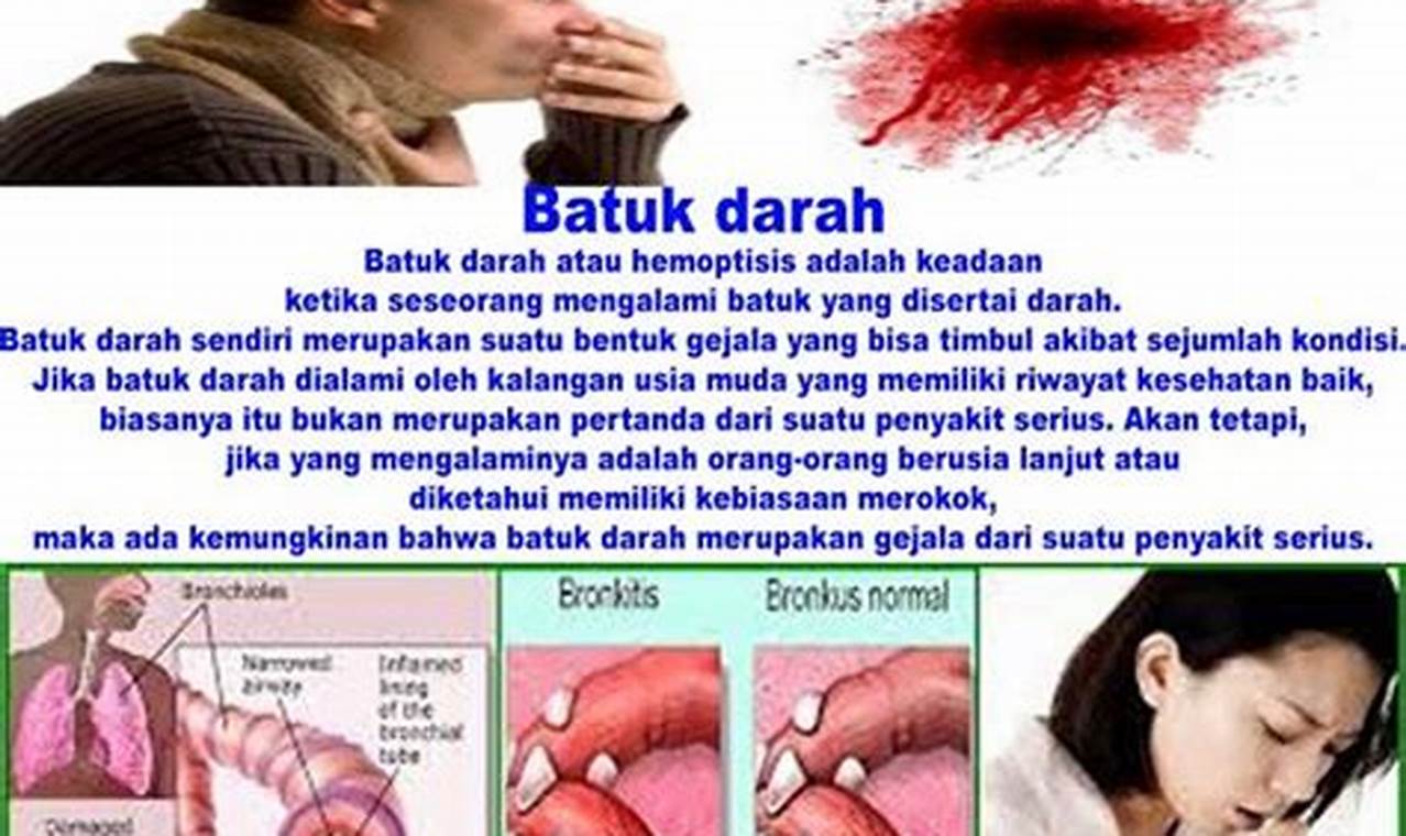Cara Mengatasi Ngantuk Terus Menerus